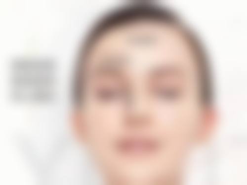 三、割双眼皮手术的修复过程