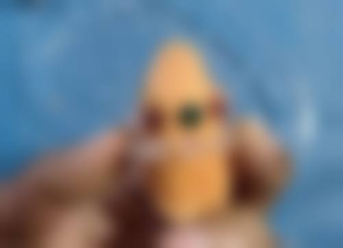 眼睛凹陷适合做什么样的双眼皮？全切与眶隔脂肪释放填充术或是优选方案