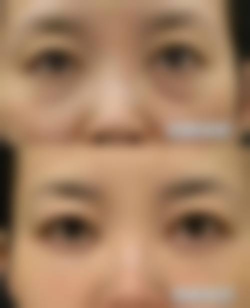 八、成都中 医 药大学附属医院整形美容科真实的患者评价