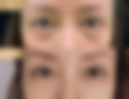 五、成都中 医 药大学附属医院整形美容科价格表