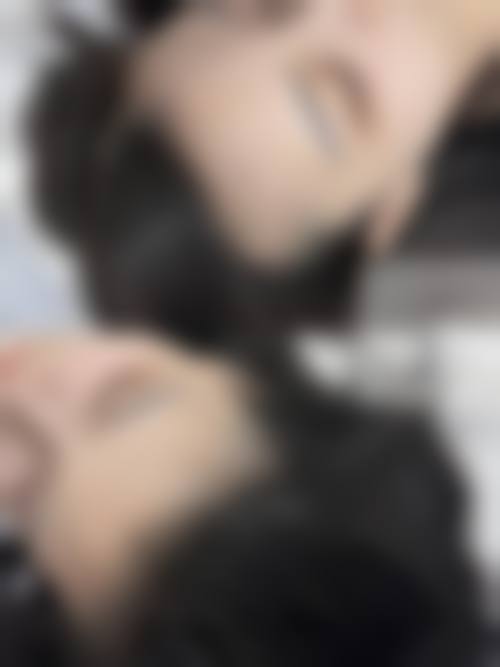 八、济宁医莱美整形医院真实的患者评价