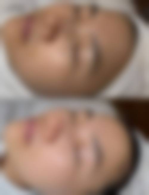 二、遵义市中医院皮肤美容科怎么样？