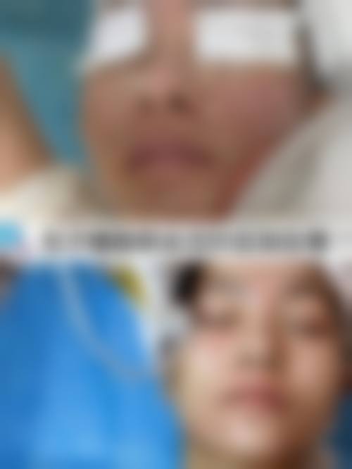 三、遵义市中医院皮肤美容科诊疗项目有哪些？