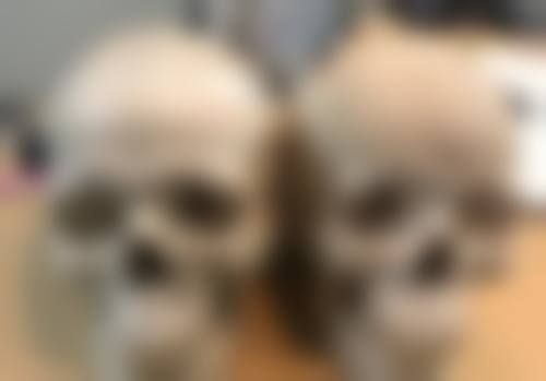 一、从家族遗传看如何区分疤痕体质