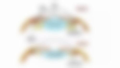 四、手术修复解决顽固甲亢手术疤痕