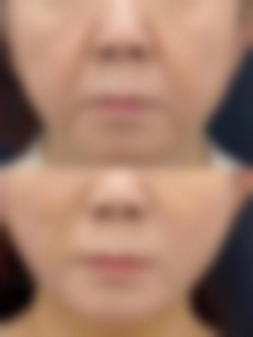 九、徐州新健康医院医学美容中 心真实的患者评价