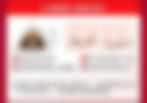 六、与大牌对比：高性价比解决眼袋黑眼圈脂肪粒
