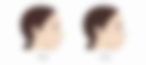 二、核心成分解析：应对眼袋黑眼圈脂肪粒有妙招