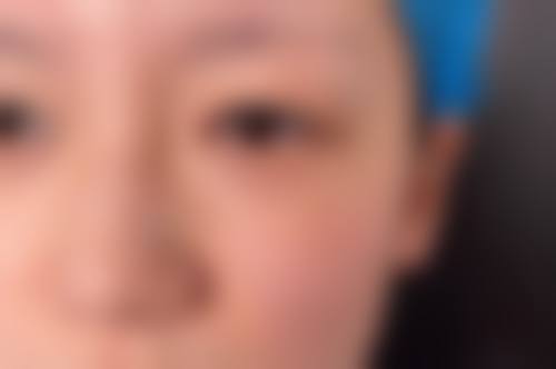 八、长春林俊整形美容诊所真实的患者评价