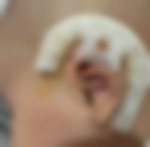 七、深圳花斓整形医院预约方式