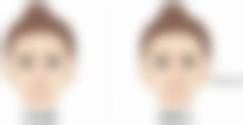 中度眼袋怎么治疗恢复快？这些方法助你快速消除眼袋重拾眼部光彩