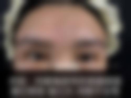 八、安阳爱美丽医疗美容门诊部真实的患者评价