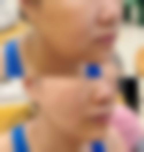 四、成都绮澳医疗美容诊所特色项目