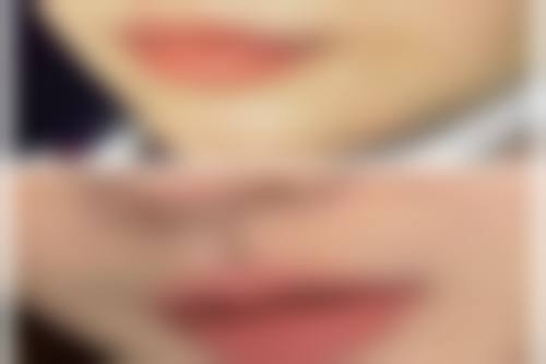 二、后变的双眼皮是什么基因型?基因基础科普