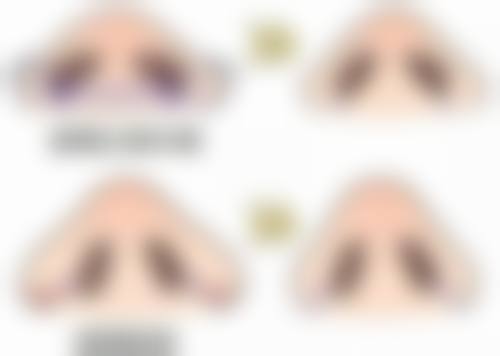 双眼皮拆线拆多久？术后时间大揭秘，顺便了解拆线后多久能化妆！ 