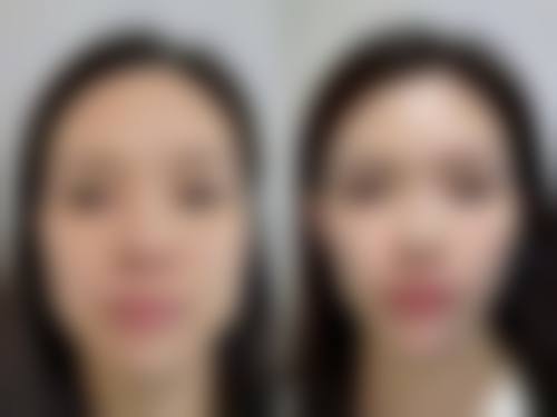四、广州市人民医院整形美容科特色项目