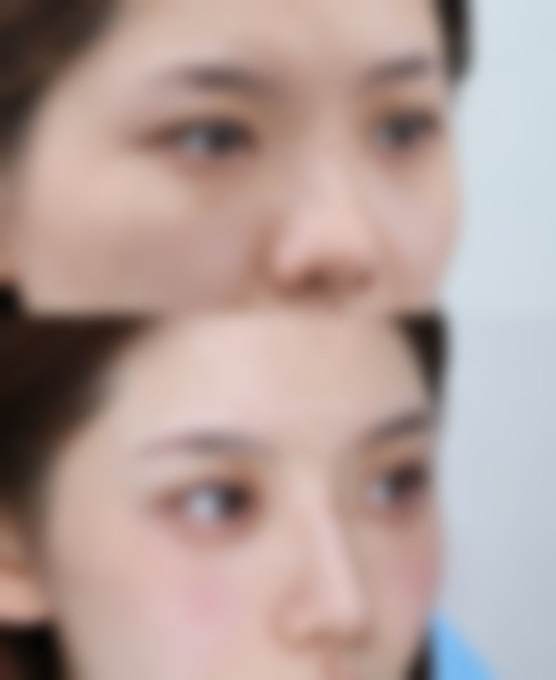 五、日常护理小贴士