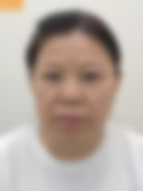 六、上海爱美仕医院整形美容中 心价格表