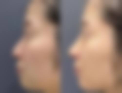 四、日常注意事项