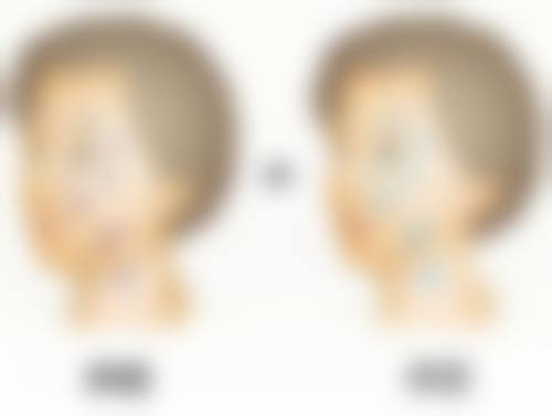 双眼皮成内双了怎么办？教你有效方法让双眼皮有望重新变回来！ 