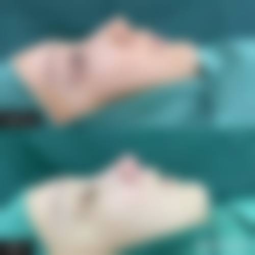九、厦门左语医疗美容诊所真实的患者评价