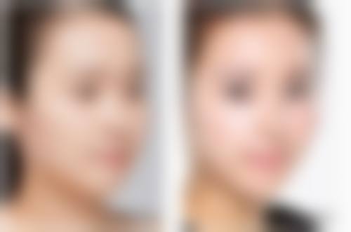 八、天津现代女子医院整形美容中 心真实的患者评价