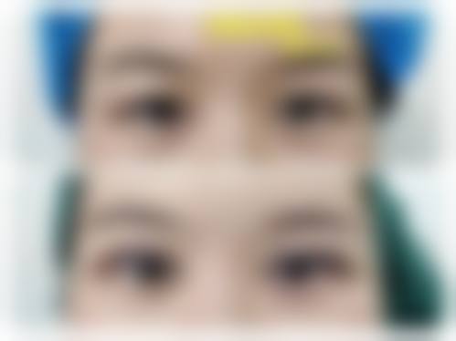 六、山西阳泉市美亚医学整形美容价格表