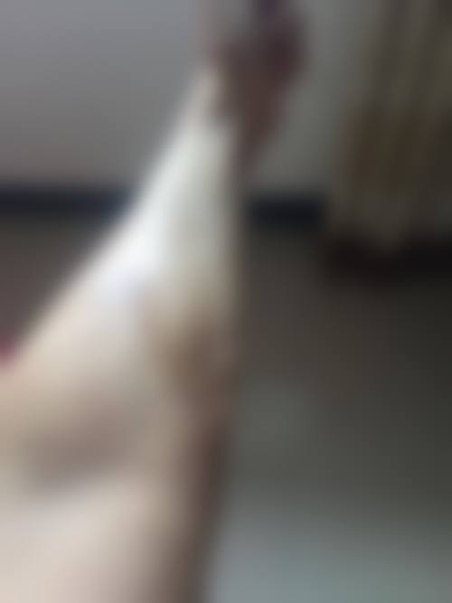 五、郭红磊怎么预约？