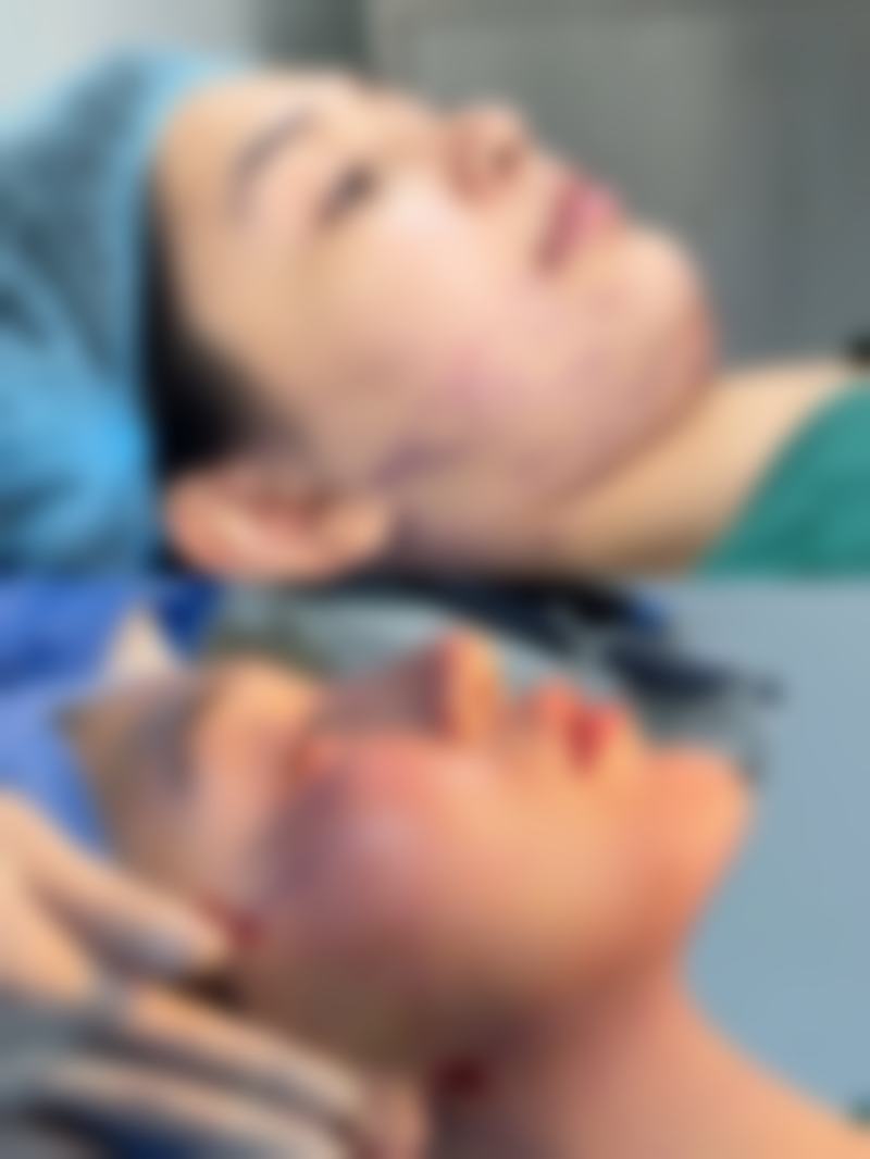 一、激光治疗助力老疤痕改善
