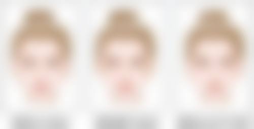 一、埋线双眼皮原理及适用人群