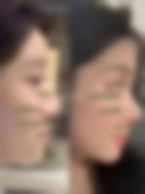 四、湘南美容金沢特色项目