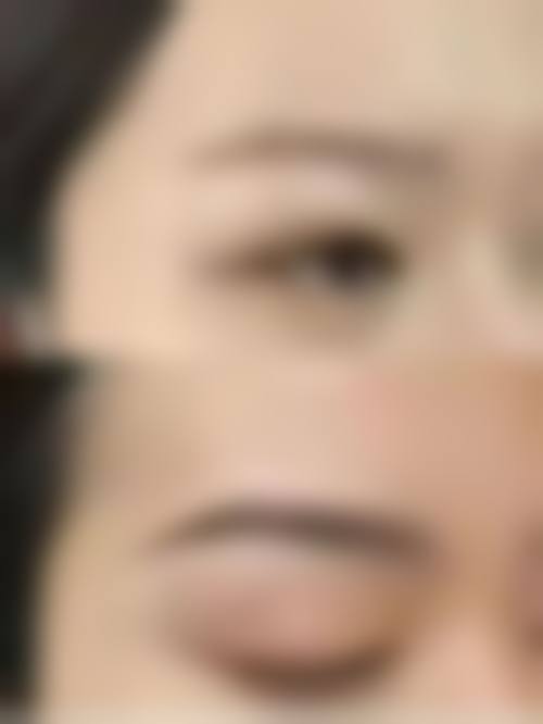 八、湘南美容金沢真实的患者评价