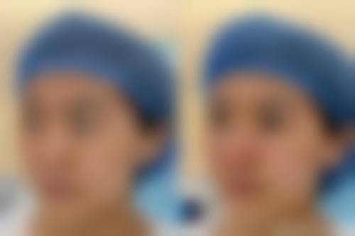四、永州佳美医学整形美容中 心特色项目