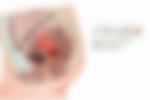 三、纳米无痕双眼皮术后护理