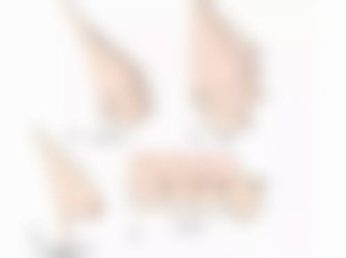 五、如何预防点痣后疤痕增生