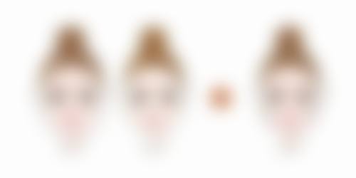 三、感染与点痣后疤痕增生
