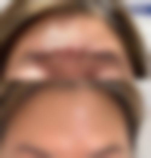 四、成都王小肤皮肤医疗美容门诊部特色项目