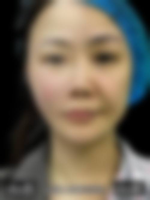 八、温州莱尚医疗美容门诊部真实的患者评价