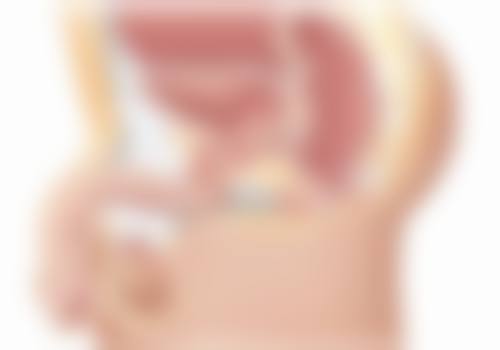 三、手术治疗十几年凹陷性疤痕