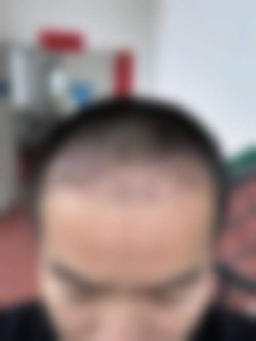 八、杭州乐肤植发中 心(保元泽第花苑店)预约方式