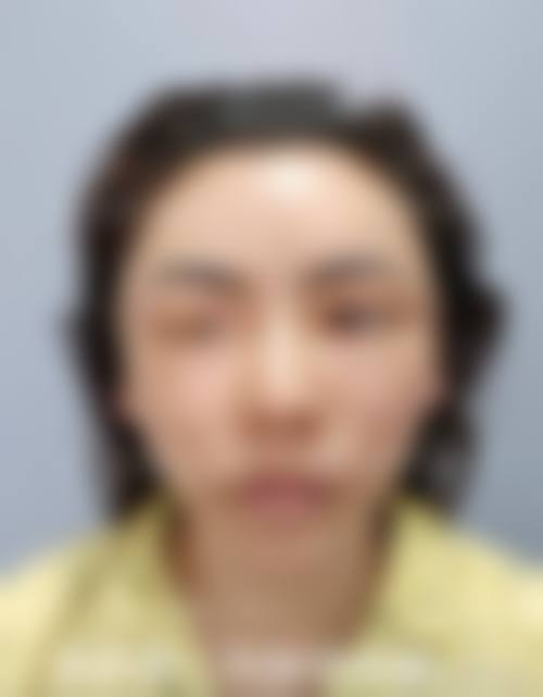 九、广西民族医院医学美容科真实的患者评价