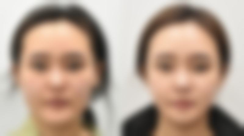 二、面诊沟通