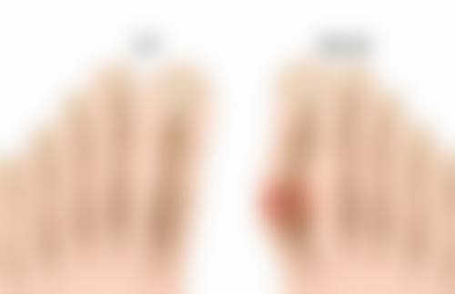 五、不恰当护肤方式引起的眼袋黑眼圈好重