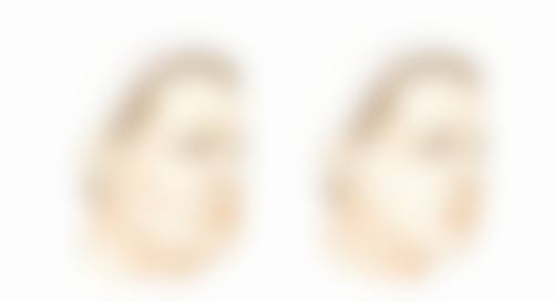 做完双眼皮可以吃蓝莓吗？蓝莓助力恢复，还能降低留疤风险！ 