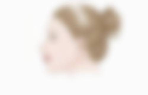 双眼皮眼综合包括哪些项目及费用揭秘，多因素影响价格你知道吗？ 