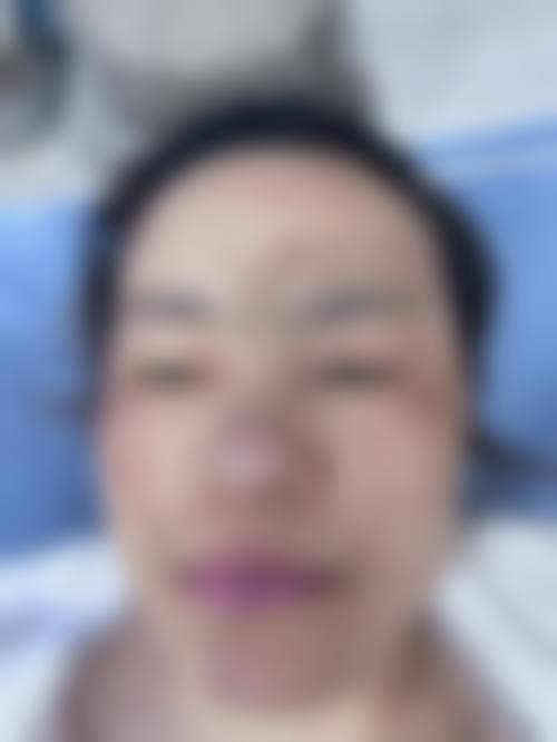 八、兰州汇盛整形医院真实的患者评价