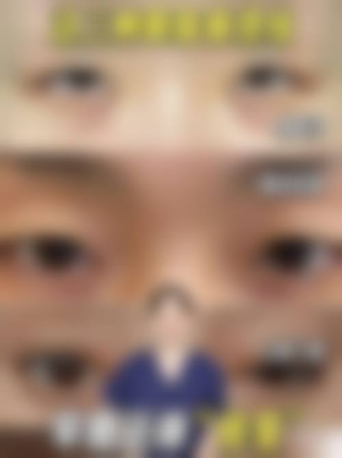 三、兰州汇盛整形医院诊疗项目有哪些?