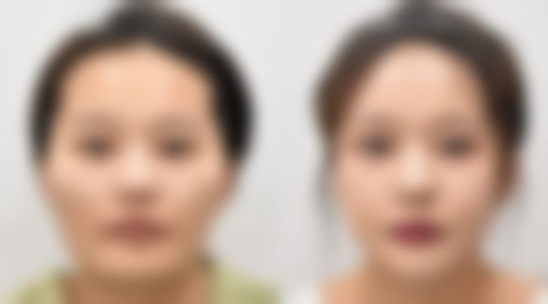 韩国RESPECT整形外科刘明植擅长项目：面部整形，为您雕琢自然精致面容