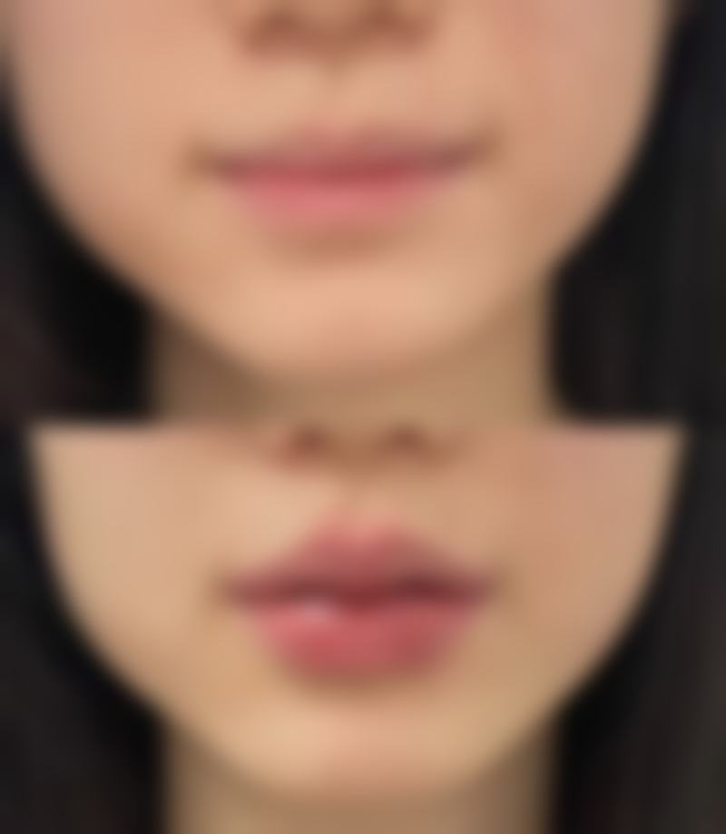五、实例分享