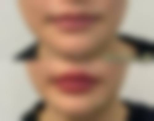 三、仙桃博美整形医疗美容门诊部诊疗项目有哪些?